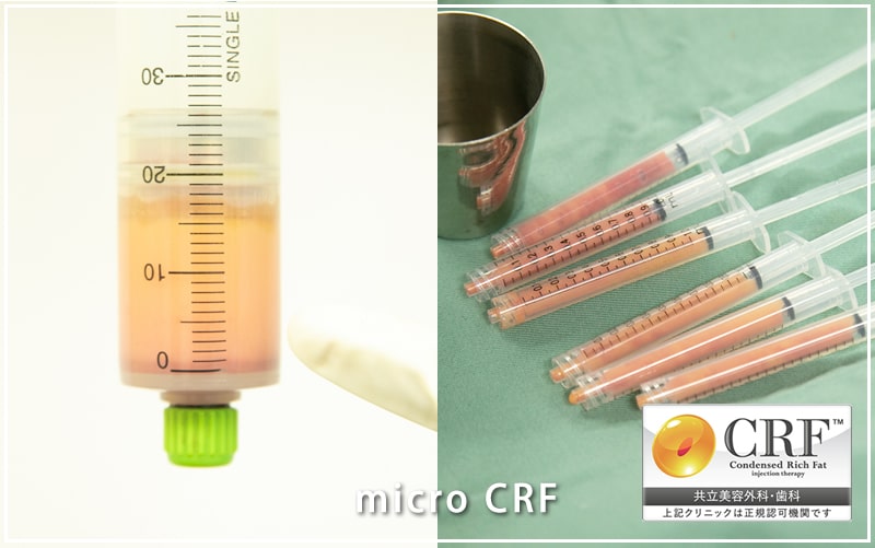 Micro CRF（マイクロCRF）