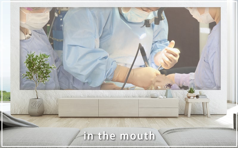 口の中から骨を削る医者