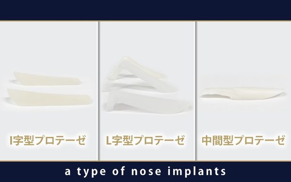 鼻のプロテーゼの3つの型
